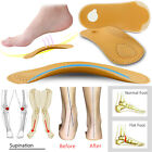 High Arch Support Flat Feet Foot Orthotic Insoles Leather For Plantar Fasciitis
