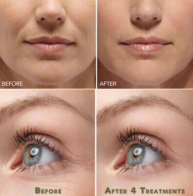 Hyaluronic Acid Gel Cream - Anti-Aging Wrinkle Face & Eye (HA) Serum Moisturizer