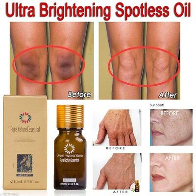Ultra Brightening Spotless Oil Dark Spot Removal Natural Pure Oil Skin Care 10ml