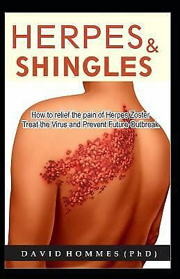 HERPES AND SHINGLES: How to Relief The Pain of Herpes zoster ,Treat the Virus an