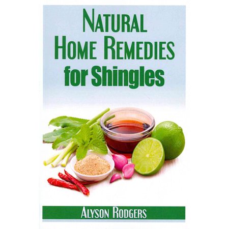 Natural Home Remedies for Shingles
